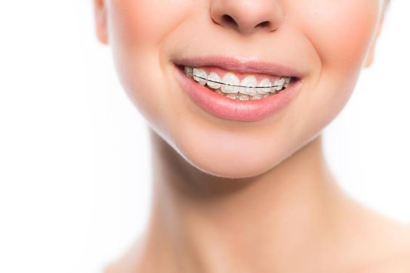 orthodontic services 